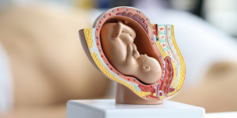 an obstetric figure of baby